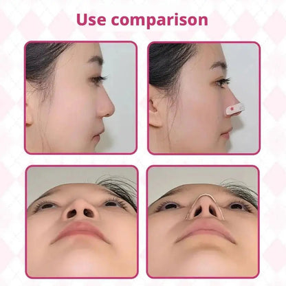 Reusable Nose Shaping & Lifting Strips (10, 20 or 30-Pack) - Healing Shop