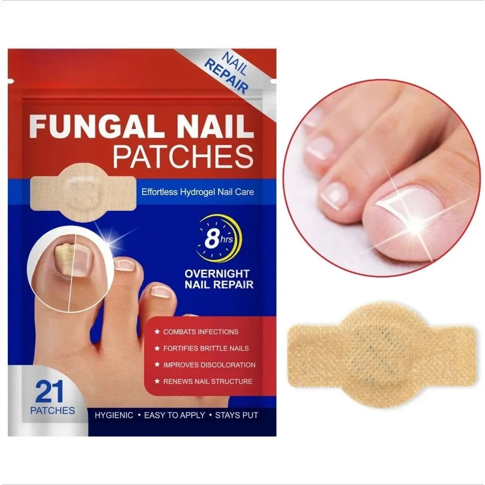 Nail Fungus Patch Waterproof Nail Repair Patch Ingrown Correction Sticker Damaged Nail Gray Care Patch Feet Care Tools - Healing Shop