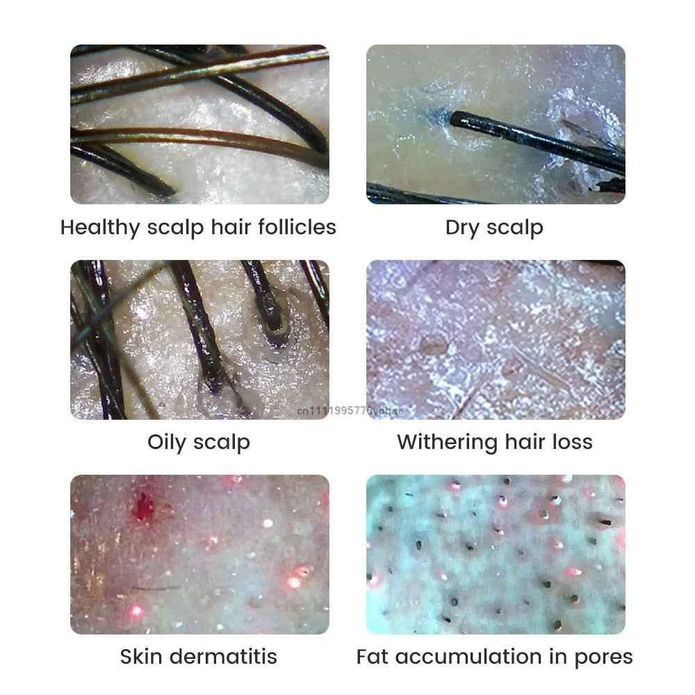 1000 times Wireless Dermatoscope Scalp Skin Analyzer Machine Facial and Body Analyzer Electronics Microscope Beauty Health Pro - Healing Shop