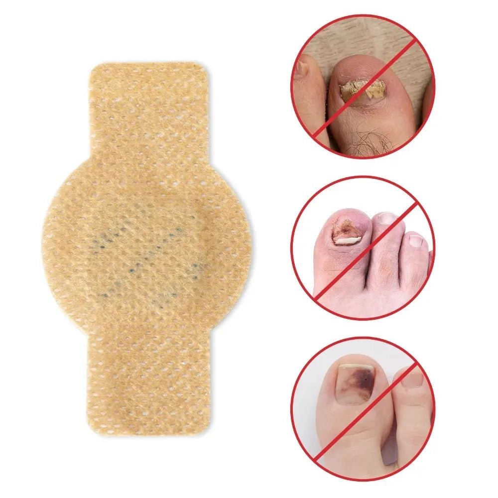 Nail Fungus Patch Waterproof Nail Repair Patch Ingrown Correction Sticker Damaged Nail Gray Care Patch Feet Care Tools - Healing Shop
